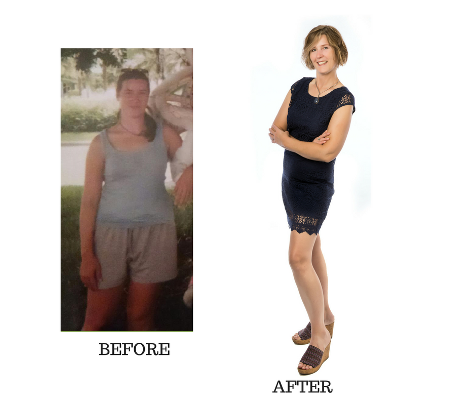 Hypnosis for weight loss, insomnia, stress, anxiety, chronic illness recovery